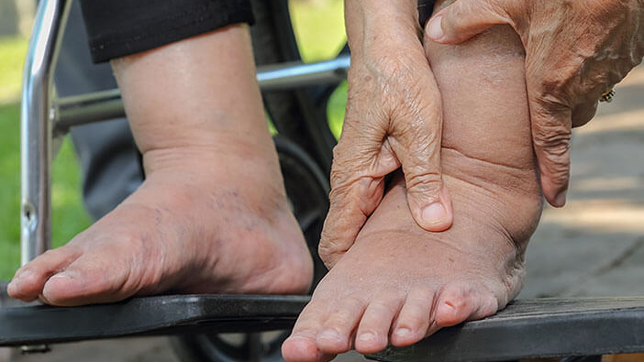 kaki gajah
